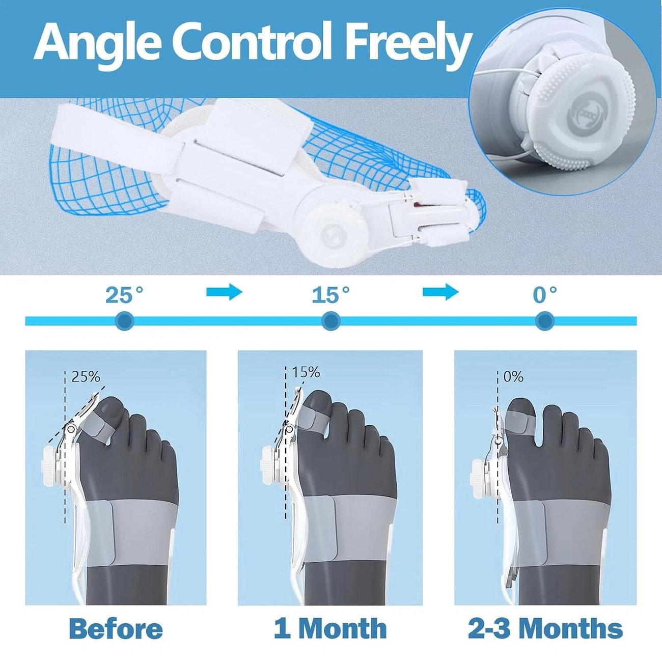 🔥Big Promotion 49% OFF💥Orthopedic Bunion Corrector