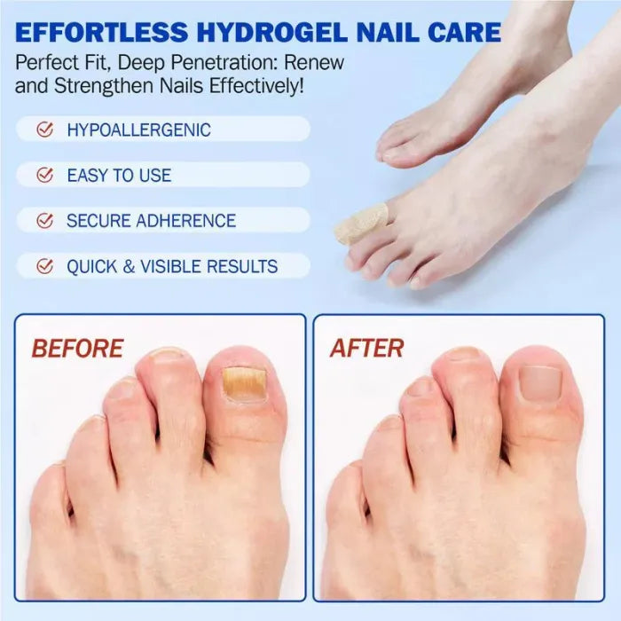 Nail Health Care Patches, Nail Fungus Care Patches, Suitable for Solving Fungal Nails and Other Nail Problems(21 Patches)
