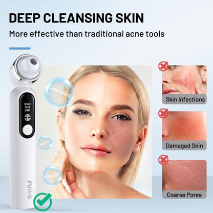 🔥Limited Time 50% OFF⚡Visible Exfoliator Vacuum Cleaner, Skin Scrubber with Camera