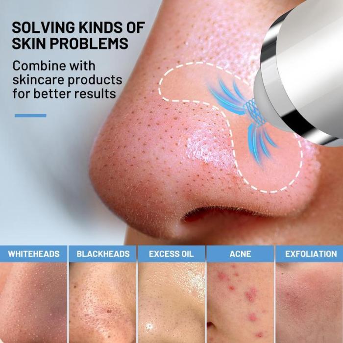 🔥Limited Time 50% OFF⚡Visible Exfoliator Vacuum Cleaner, Skin Scrubber with Camera