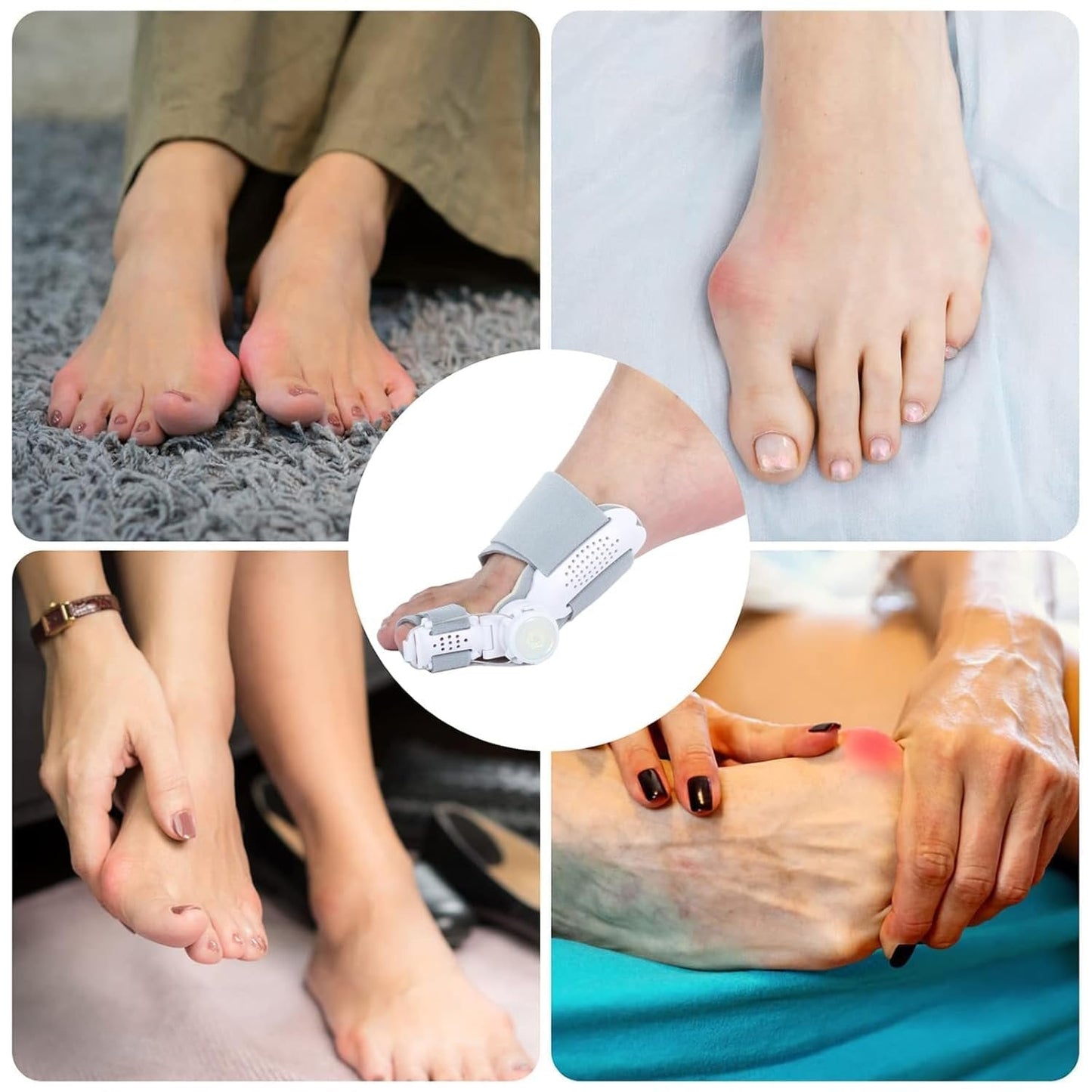 🔥Big Promotion 49% OFF💥Orthopedic Bunion Corrector