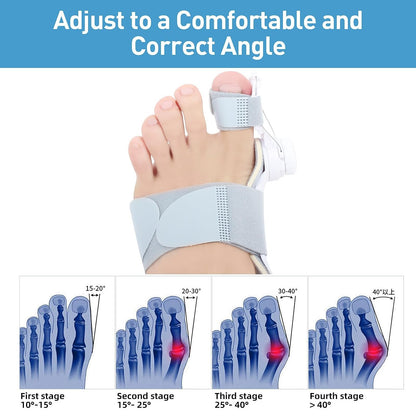 🔥Big Promotion 49% OFF💥Orthopedic Bunion Corrector