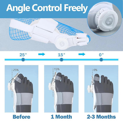 🔥Big Promotion 49% OFF💥Orthopedic Bunion Corrector