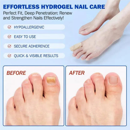 Nail Health Care Patches, Nail Fungus Care Patches, Suitable for Solving Fungal Nails and Other Nail Problems（21 Patches）
